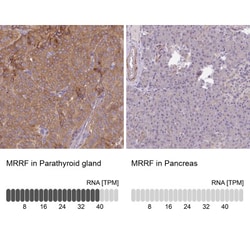 MRRF Antibody, Novus Biologicals:Antibodies:Primary Antibodies